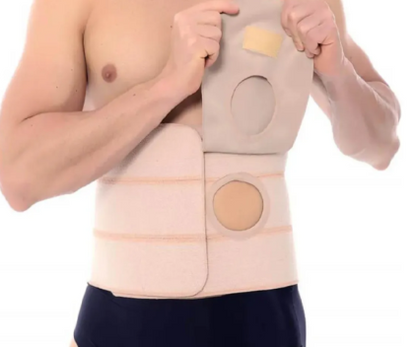 FAIXA ELÁSTICA  COM ABERTURA PARA BOLSA DE COLOSTOMIA - BIOBELA